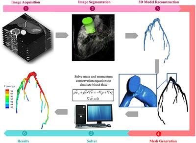 Application of Patient-Specific Computational Fluid Dynamics in Coronary and Intra-Cardiac Flow Simulations: Challenges and Opportunities